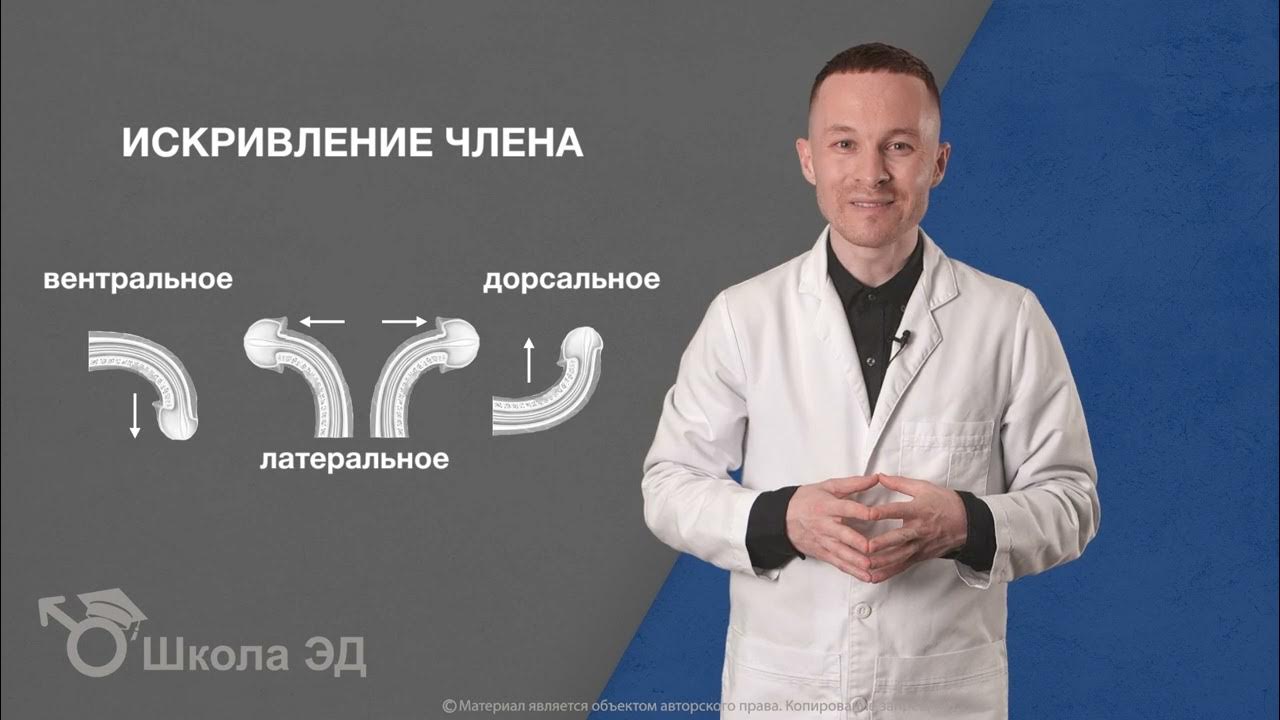 Урок 28 Искривление члена (болезнь Пейрони) и потенция